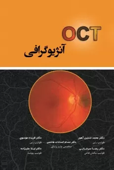 OCT آنژیوگرافی